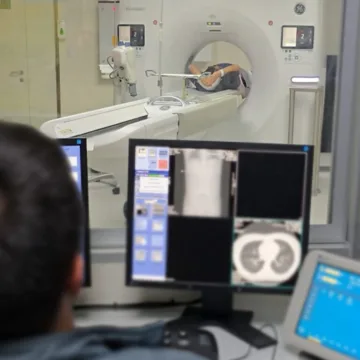 Hospital Dr. Hernán Henríquez Aravena fortalece su capacidad diagnóstica con moderno tomógrafo de última generación
