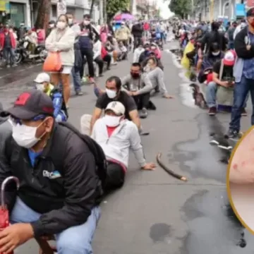 imagen_2026-05-18_221809963 Perú declara emergencia sanitaria por brote de sarampión y activa alerta epidemiológica nacional