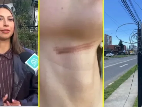 Municipio de Temuco acompaña a ciclista accidentada por cable en desuso y evalúa acciones legales
